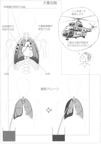 ヘリコプター搬送①